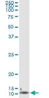 Anti-CXCL8 Antibody Pair