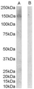 EB06903 (0.1 µg/ml) staining of Jurkat lysate (35µg protein in RIPA buffer) with (B) and without (A) blocking with the immunising peptide.  Primary incubation was 1 hour.  Detected by chemiluminescence.