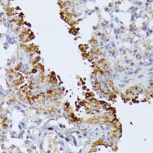 Immunohistochemistry analysis of paraffin-embedded mouse lung using Anti-SEPT4 Antibody (A11271) at a dilution of 1:100 (40X lens). Perform microwave antigen retrieval with 10 mM PBS buffer pH 7.2 before commencing with IHC staining protocol