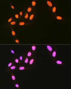 Anti-hnRNP Q antibody