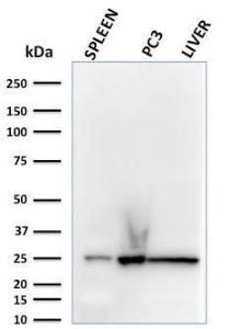 Western blot analysis of human spleen, PC3 cell, and liver lysates using Anti-C1QA Antibody [C1QA/2783]