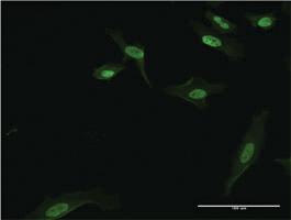 Anti-BATF3 Mouse Monoclonal Antibody [clone: 3H1]