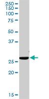 Anti-ITM2B Rabbit Polyclonal Antibody