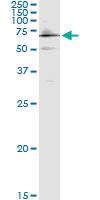 Anti-CYP27A1 Polyclonal Antibody Pair