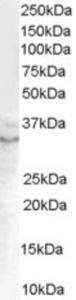 EB06909 (0.1 µg/ml) staining of Human Prostate lysate (35 µg protein in RIPA buffer).  Primary incubation was 1 hour.  Detected by chemiluminescence.