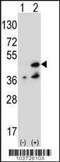 Anti-Nucleoside Diphosphate Kinase 7 Rabbit Polyclonal Antibody (Biotin)