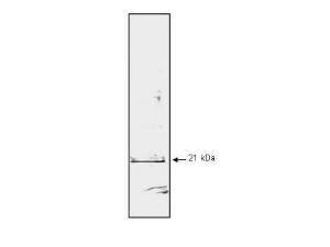 MS anti-P21/WAF1 human 100 μg