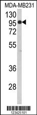 Anti-BAHD1 Rabbit Polyclonal Antibody