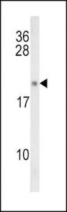 Anti-IL21 Rabbit Polyclonal Antibody (AP (Alkaline Phosphatase))