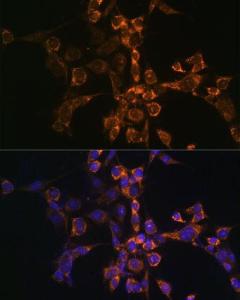 Immunofluorescence analysis of NIH-3T3 cells using Anti-SEPT4 Antibody (A11271) at a dilution of 1:100 (40X lens). DAPI was used to stain the cell nuclei (blue)