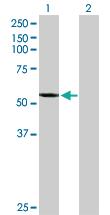 Anti-CYP2A7 Rabbit Polyclonal Antibody