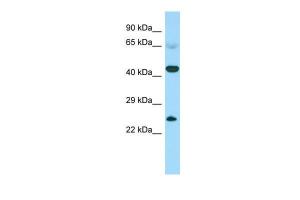 Anti-CABS1 Rabbit Polyclonal Antibody