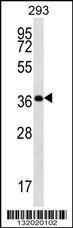 Anti-OR10H5 Rabbit Polyclonal Antibody (PE (Phycoerythrin))