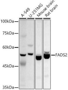 Western blot analysis of extracts of various cell lines, using Anti-FADS2 Antibody (A11273) at 1:1,000 dilution. The secondary antibody was Goat Anti-Rabbit IgG H&L Antibody (HRP) at 1:10,000 dilution.