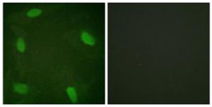 Immunofluorescence analysis of HeLa cells, treated with Forskolin 40nM 30', using Anti-SSB (phospho Ser366) Antibody. The right hand panel represents a negative control, where the antibody was pre-incubated with the immunising peptide