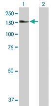 Anti-AKAP13 Rabbit Polyclonal Antibody