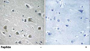 Anti-MYLIP Rabbit Polyclonal Antibody