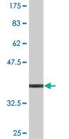 Anti-PPARGC1A Mouse Monoclonal Antibody [clone: 2F10]