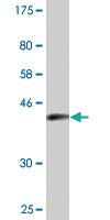 Anti-ENAH Mouse Monoclonal Antibody [clone: 3E6]