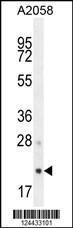 Anti-AP3S1 Rabbit Polyclonal Antibody (APC (Allophycocyanin))