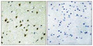 Immunohistochemical analysis of paraffin-embedded human brain tissue using Anti-MAD4 Antibody. The right hand panel represents a negative control, where the Antibody was pre-incubated with the immunising peptide