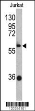 Anti-ZBTB2 Rabbit Polyclonal Antibody