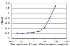 Anti-ITM2B Mouse Monoclonal Antibody [clone: 1A10]