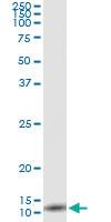 Anti-CXCL8 Antibody Pair