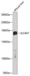 Western blot analysis of extracts of mouse liver, using Anti-SLC4A7 / NBCn1 Antibody (A11274) at 1:1,000 dilution. The secondary antibody was Goat Anti-Rabbit IgG H&L Antibody (HRP) at 1:10,000 dilution.