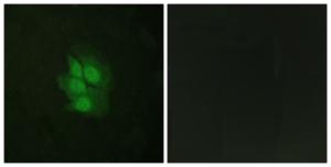 Immunofluorescence analysis of HeLa cells using Anti-p53 (phospho Ser392) Antibody. The right hand panel represents a negative control, where the antibody was pre-incubated with the immunising peptide.