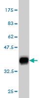 Anti-DCUN1D1 Mouse Monoclonal Antibody [clone: 3D7]