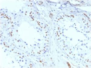 Immunohistochemical analysis of formalin-fixed, paraffin-embedded human testis using Anti-Wilms tumor Protein Antibody [rWT1/857]