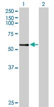 Anti-CYP3A7 Rabbit Polyclonal Antibody