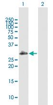 Anti-SCML1 Rabbit Polyclonal Antibody