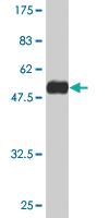 Anti-RAB22A Mouse Monoclonal Antibody [clone: 2B12]