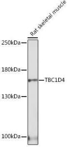 Western blot analysis of extracts of Rat skeletal muscle, using Anti-AS160 Antibody (A308790) at 1:1,000 dilution