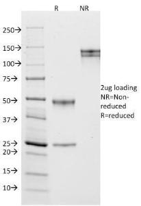 SDS-PAGE analysis of Anti-CD10 Antibody [MME/1870] under non-reduced and reduced conditions; showing intact IgG and intact heavy and light chains, respectively. SDS-PAGE analysis confirms the integrity and purity of the antibody