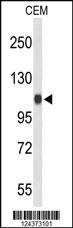 Anti-IPO11 Rabbit Polyclonal Antibody