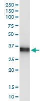 Anti-SCML1 Rabbit Polyclonal Antibody