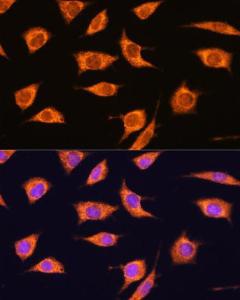 Immunofluorescence analysis of L929 cells using Anti-AS160 Antibody (A308790) at a dilution of 1:100. DAPI was used to stain the cell nuclei (blue)