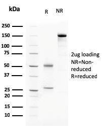 SDS-PAGE analysis of Anti-C1QA Antibody [C1QA/2783] under non-reduced and reduced conditions; showing intact IgG and intact heavy and light chains, respectively. SDS-PAGE analysis confirms the integrity and purity of the antibody.