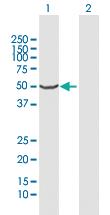 Anti-CYP2A13 Rabbit Polyclonal Antibody