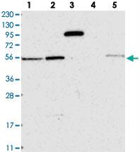 Anti-ZIM3 Rabbit Polyclonal Antibody