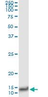 Anti-CXCL8 Antibody Pair