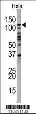 Anti-PI3KC3 Rabbit Polyclonal Antibody