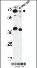 Anti-GSPT2 Rabbit Polyclonal Antibody