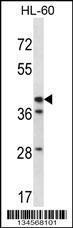 Anti-HSD3B1 Rabbit Polyclonal Antibody (HRP (Horseradish Peroxidase))