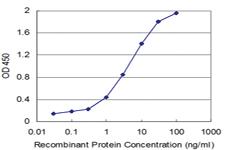 Anti-SORD Mouse Monoclonal Antibody [clone: 2B8]