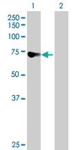 Anti-DDX43 Mouse Polyclonal Antibody