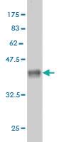 Anti-EDEM2 Mouse Monoclonal Antibody [clone: 2E4]